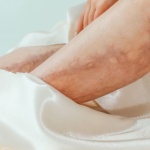 Wenn ein Bein plötzlich anschwillt: Ursachen verstehen und richtig abklären